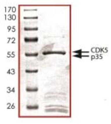 SDS-PAGE (CDK5-382H).jpg
